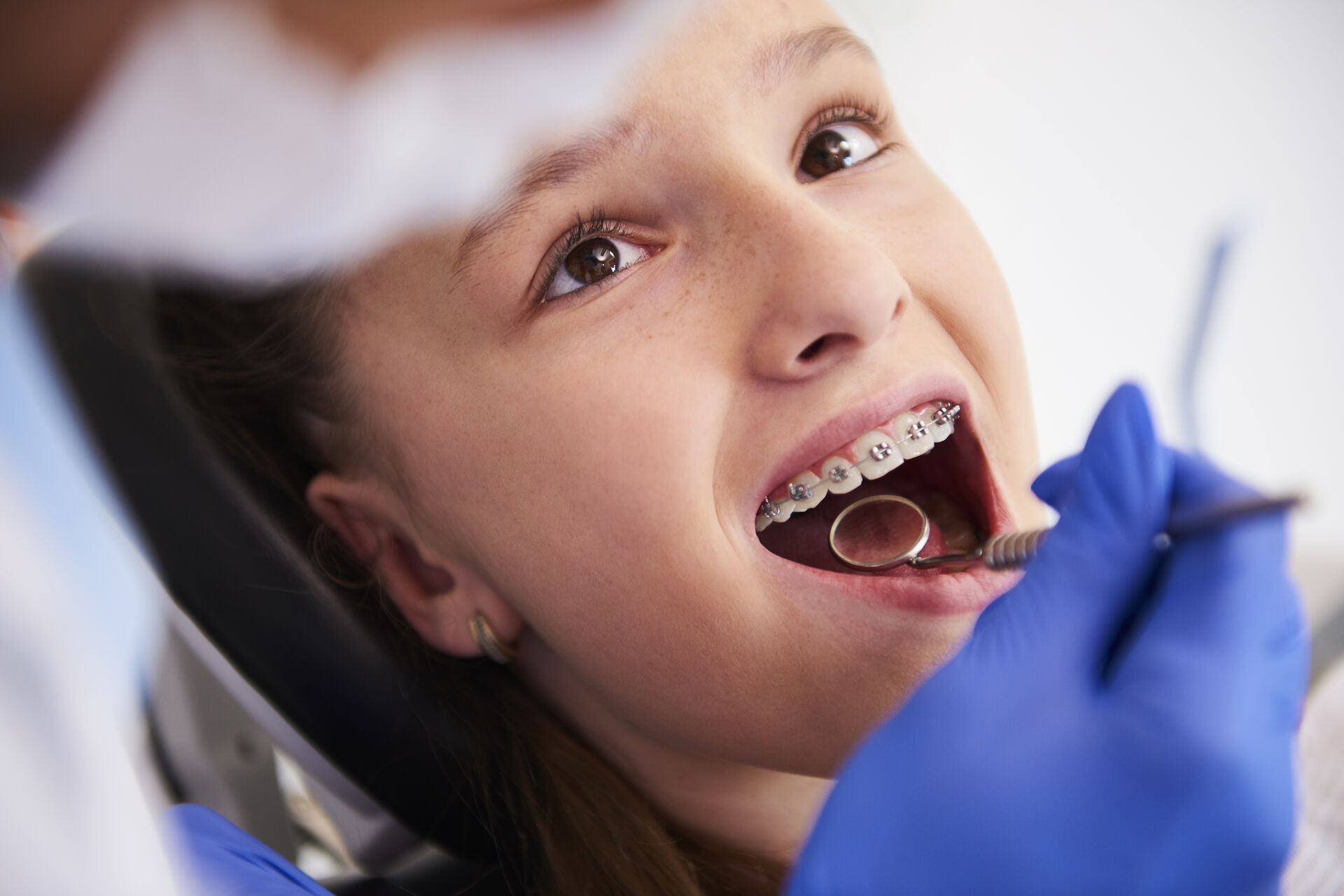 dentista bambini Torino apparecchio denti