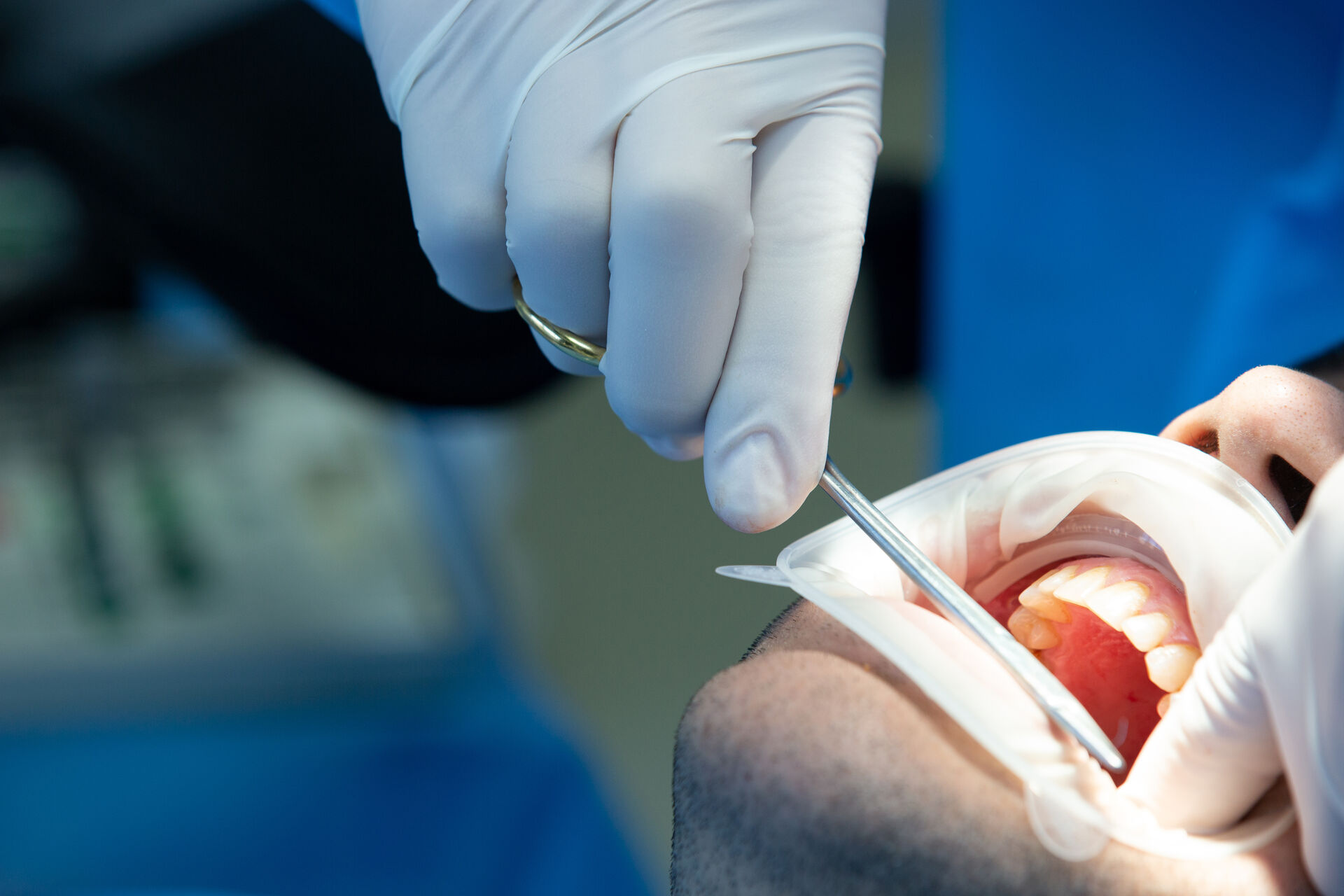 chirurgia orale Torino intervento odontoiatrico