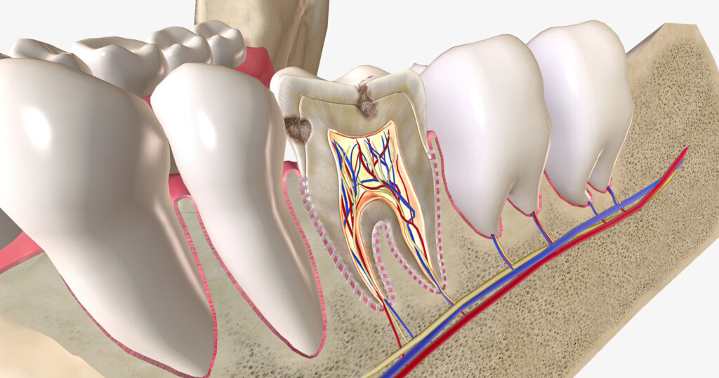 endodonzia Torino cura canalare