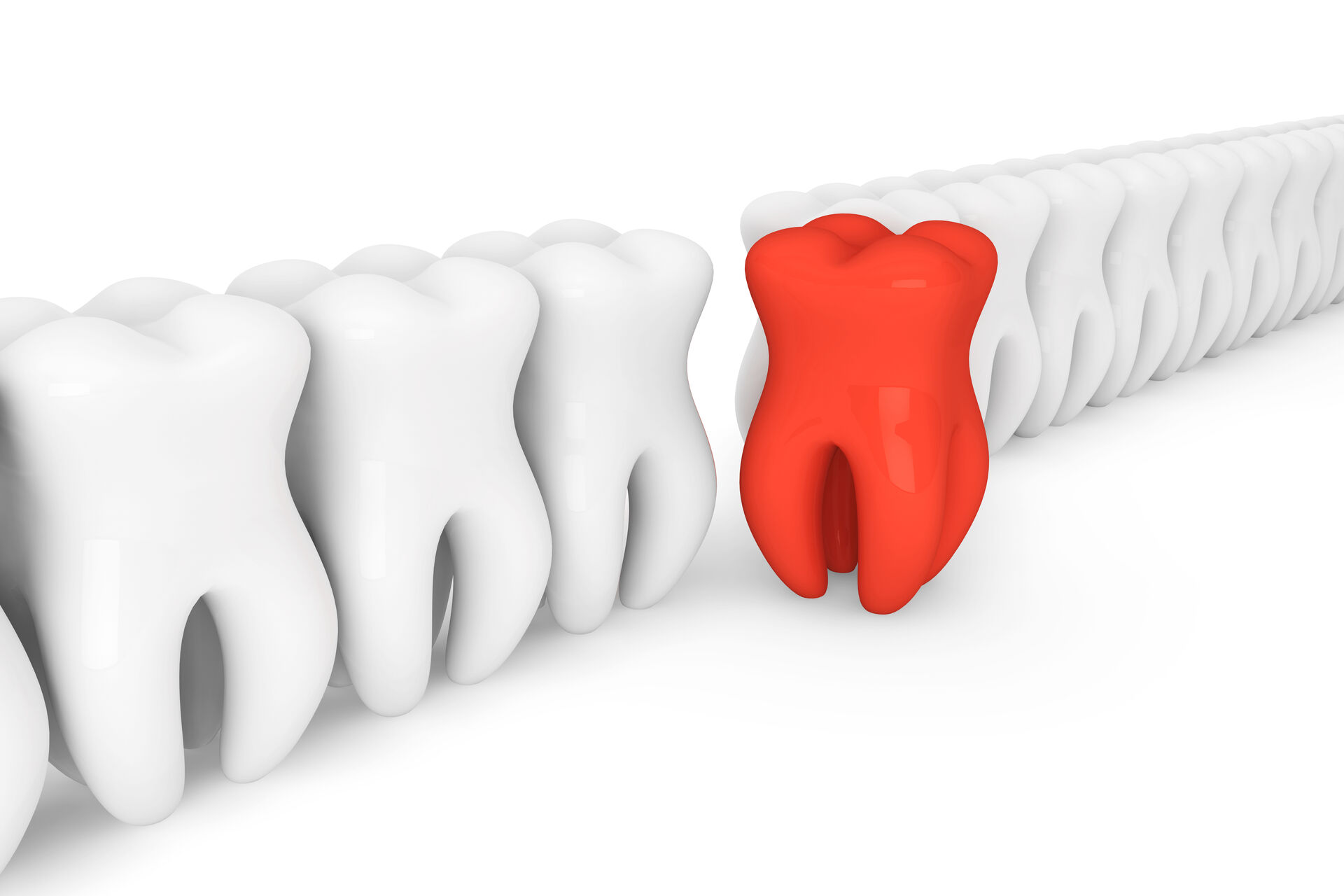 endodonzia Torino cura canalare