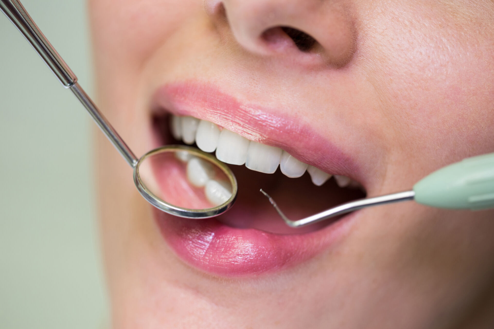 cura gengive Torino studio dentistico