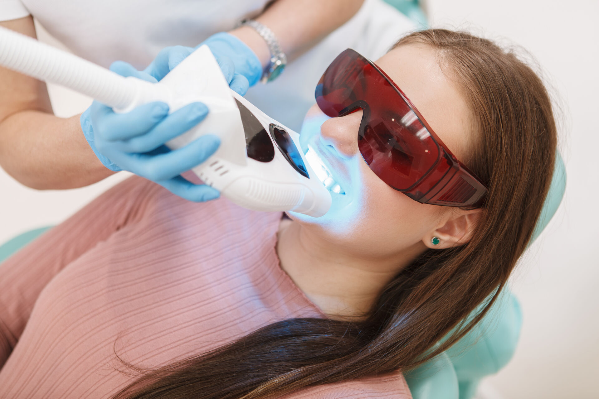 sbiancamento denti Torino trattamento