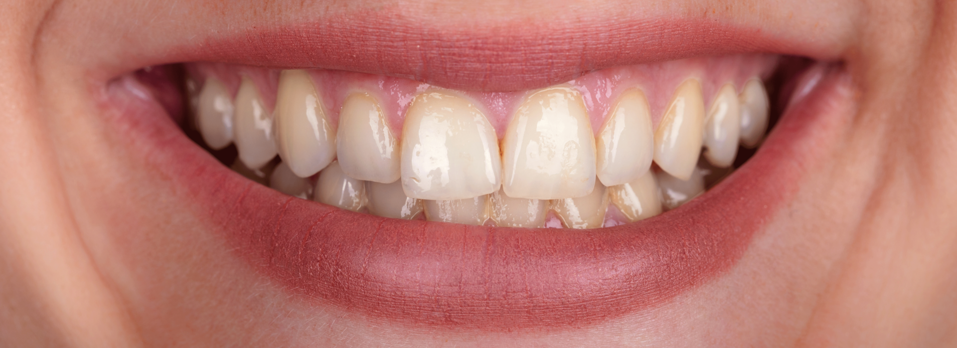dusio_dfental_care_web_001